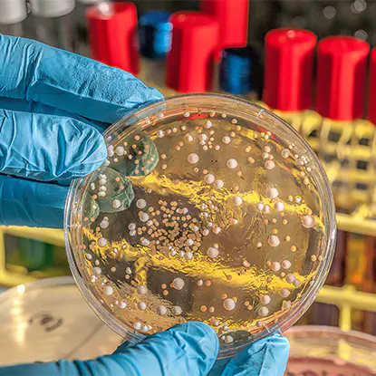 Health and Disease Control